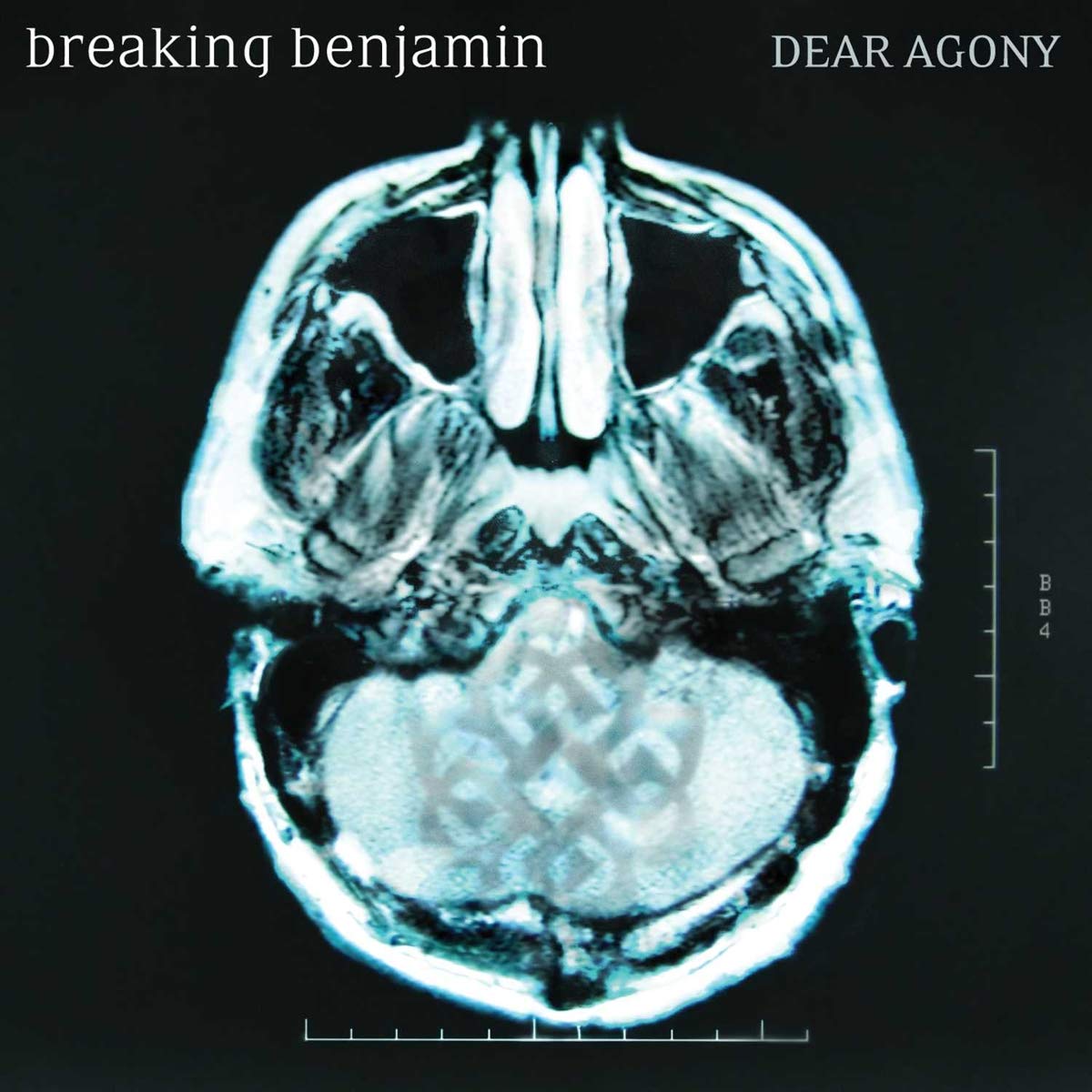 Dear Agony Metal & Hardrock