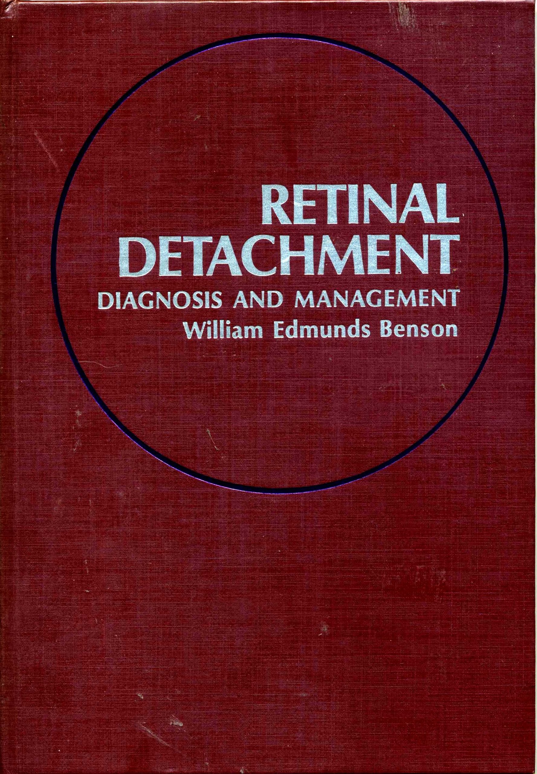 Retinal Detachment: Diagnosis and Management Medicine