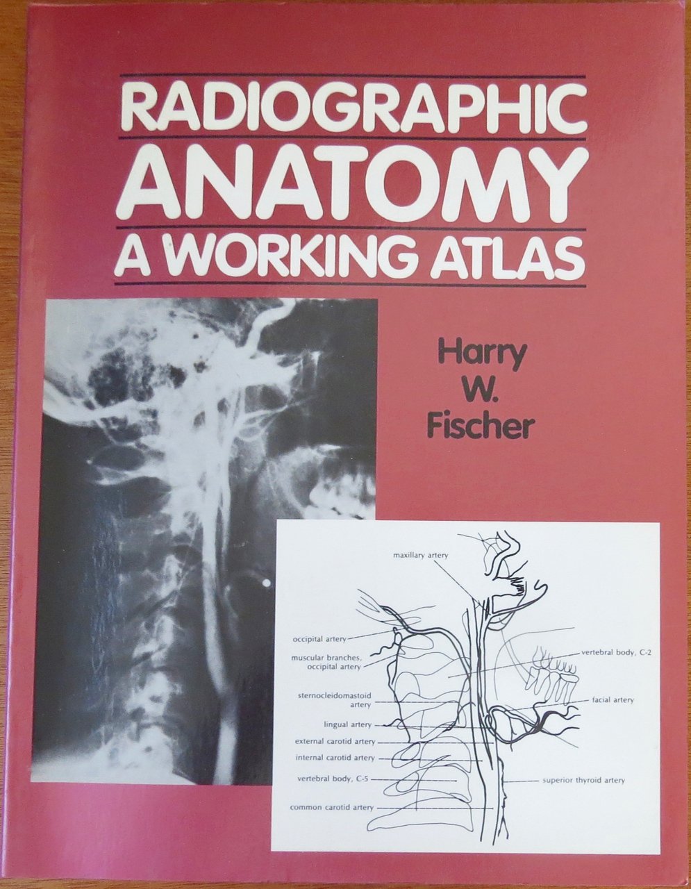 Radiographic Anatomy: A Working Atlas Medicine