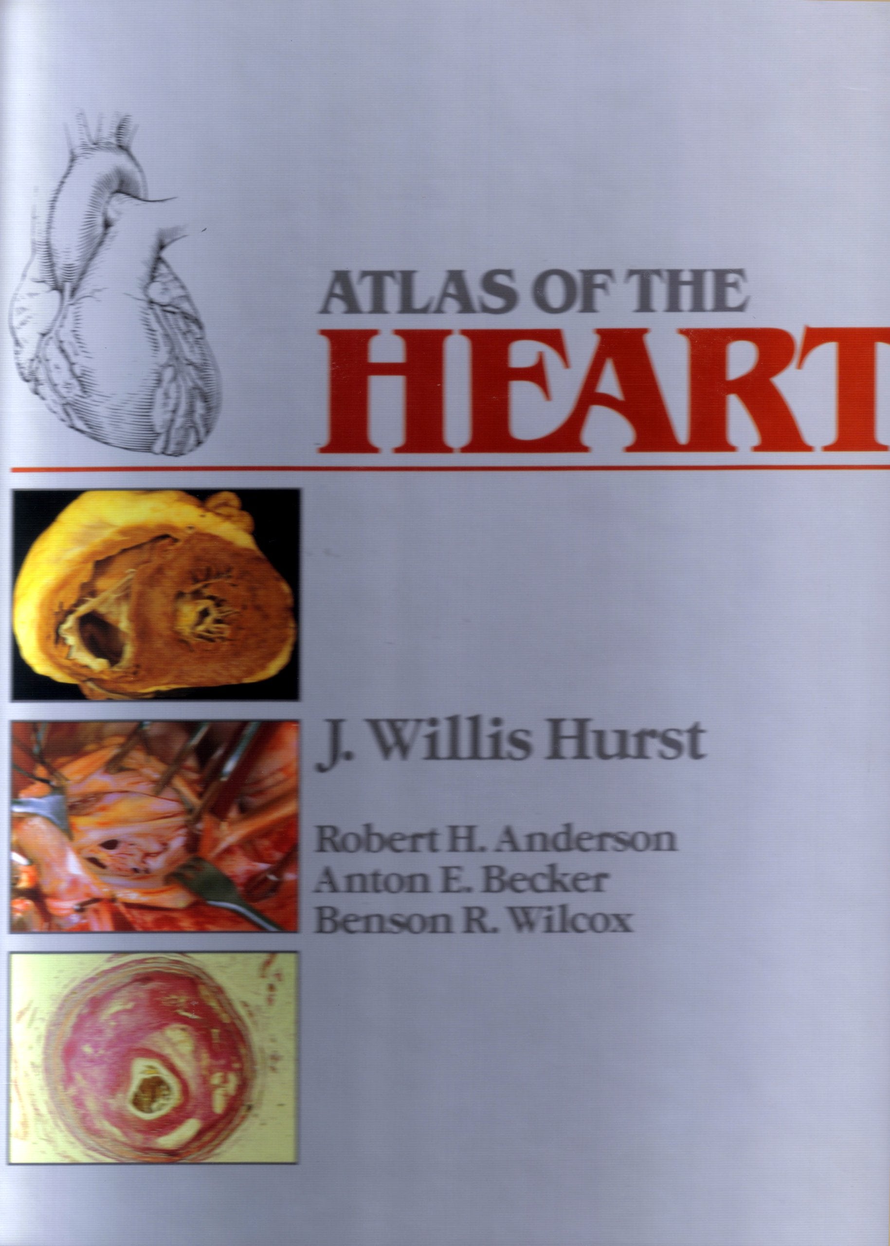 Atlas of the Heart book