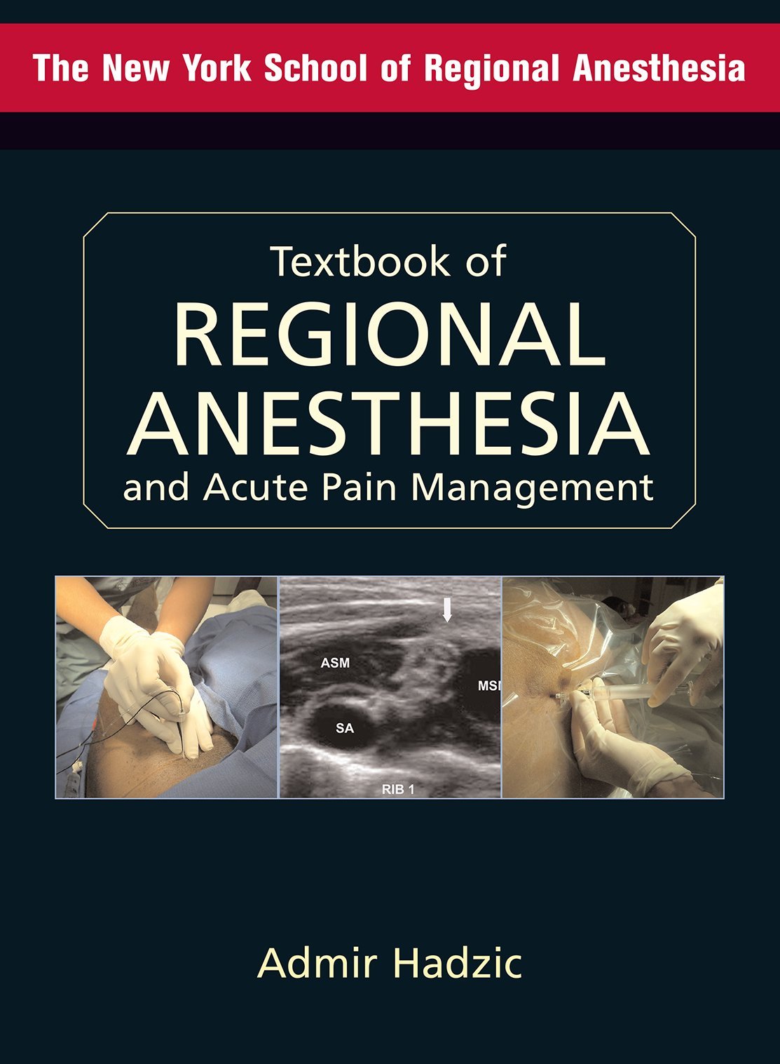 Textbook of Regional Anesthesia And Acute Pain Management Medicine