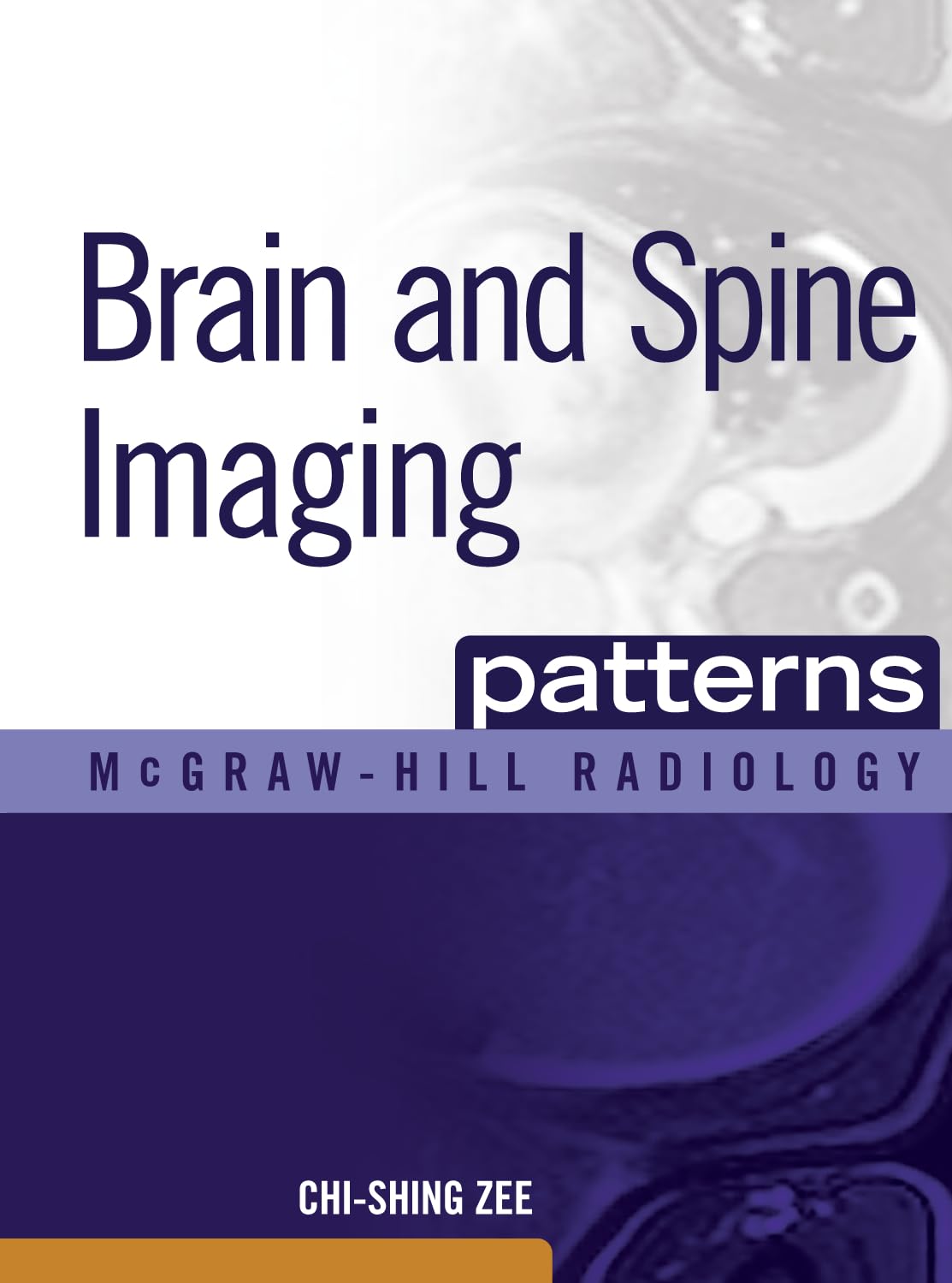 Brain and Spine Imaging Patterns: Brain & Spine Imaging (Ebook) (McGraw-Hill Radiology Series) Medicine
