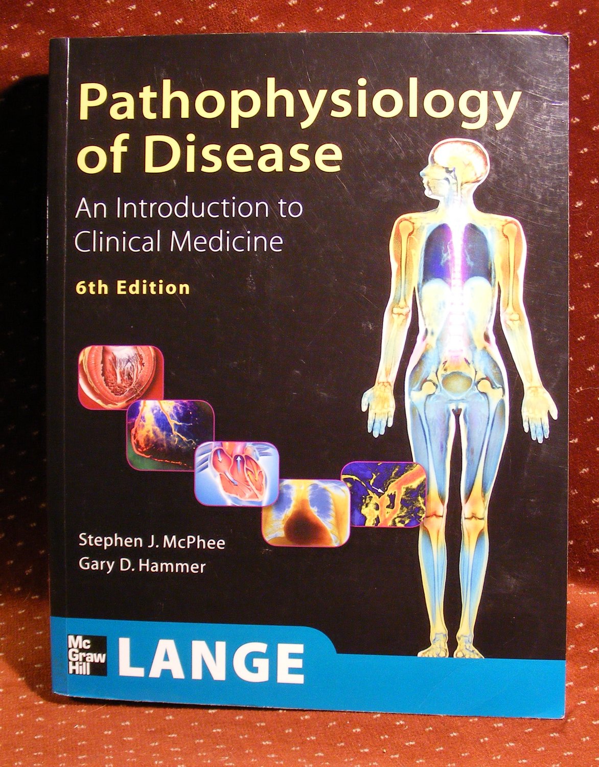 Pathophysiology of Disease: An Introduction to Clinical Medicine book