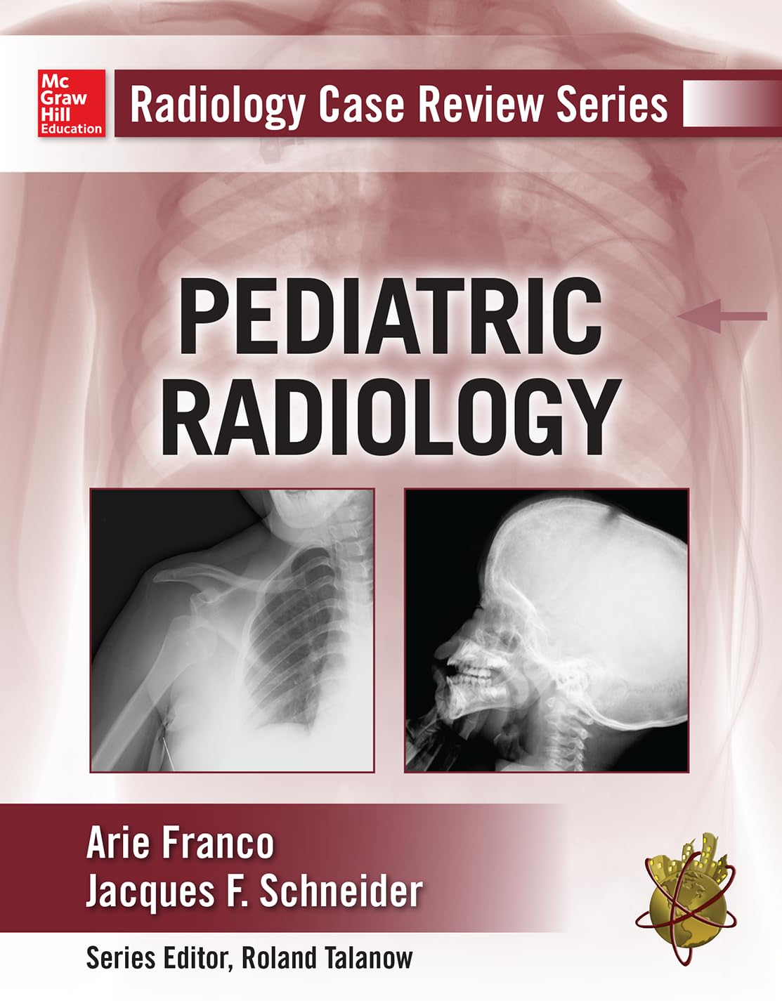Radiology Case Review Series: Pediatric Medicine