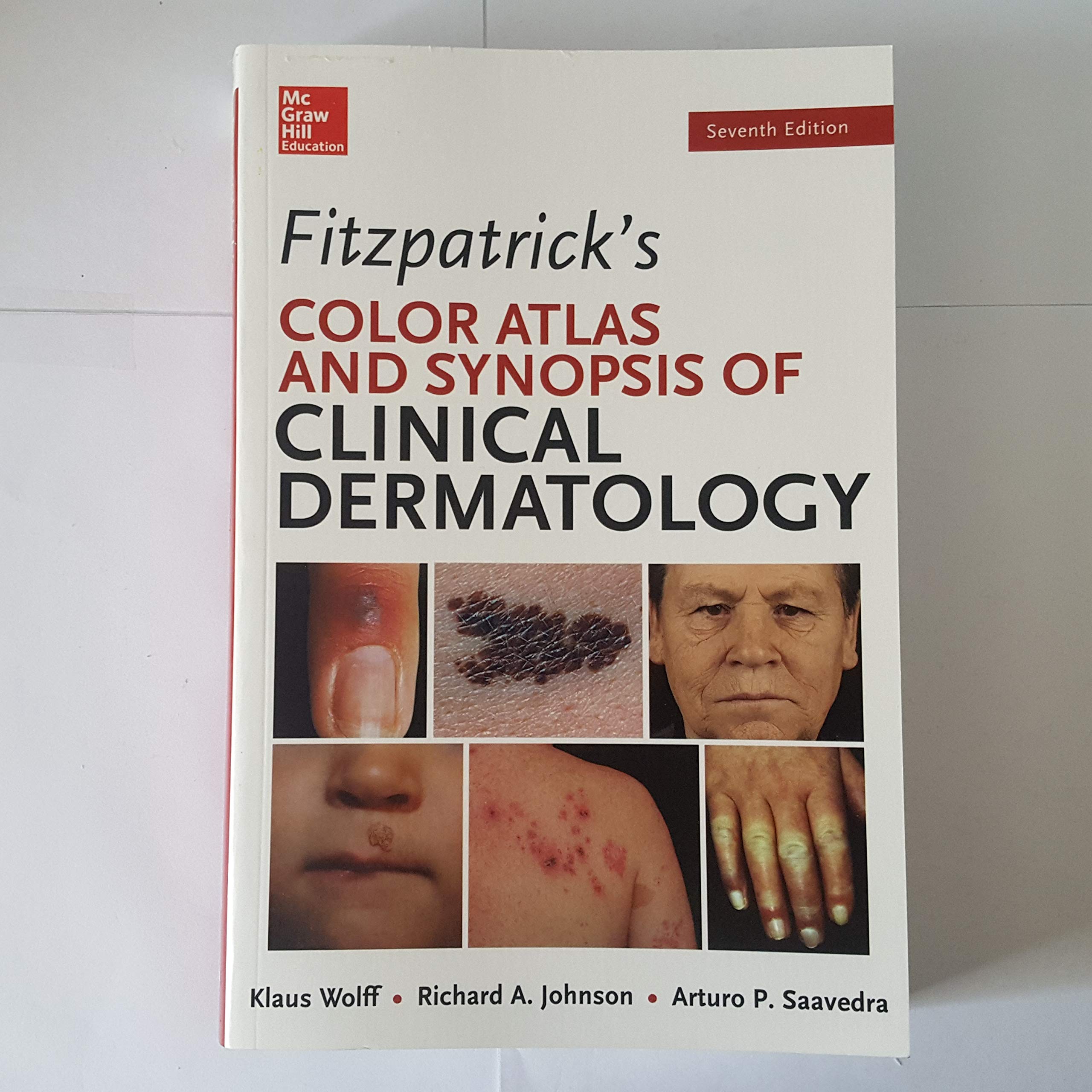 Fitzpatrick's Color Atlas and Synopsis of Clinical Dermatology (Medicina) Medicine
