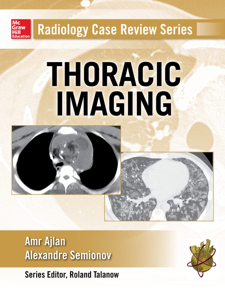 Thoracic Imaging (Radiology Case Review Series) Medicine