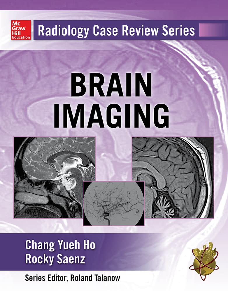 Brain Imaging (Radiology Case Review) Medicine
