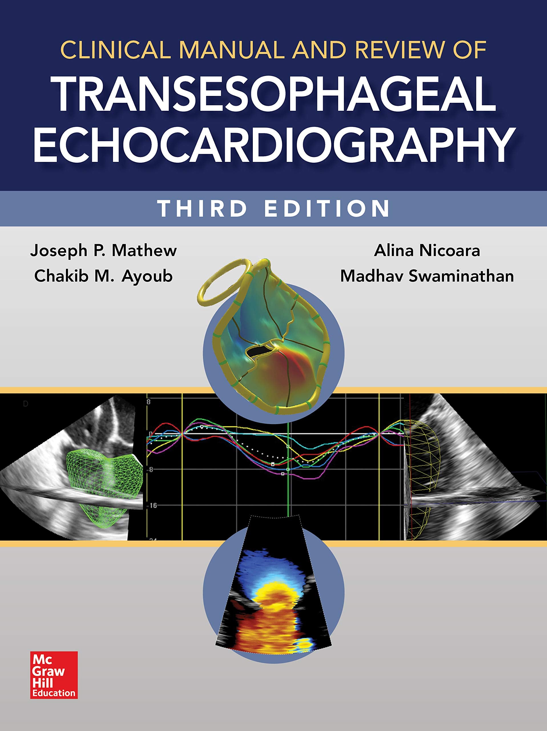 Clinical Manual and Review of Transesophageal Echocardiography Medicine