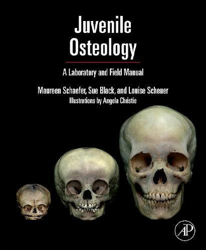 Juvenile Osteology: A Laboratory and Field Manual Medicine