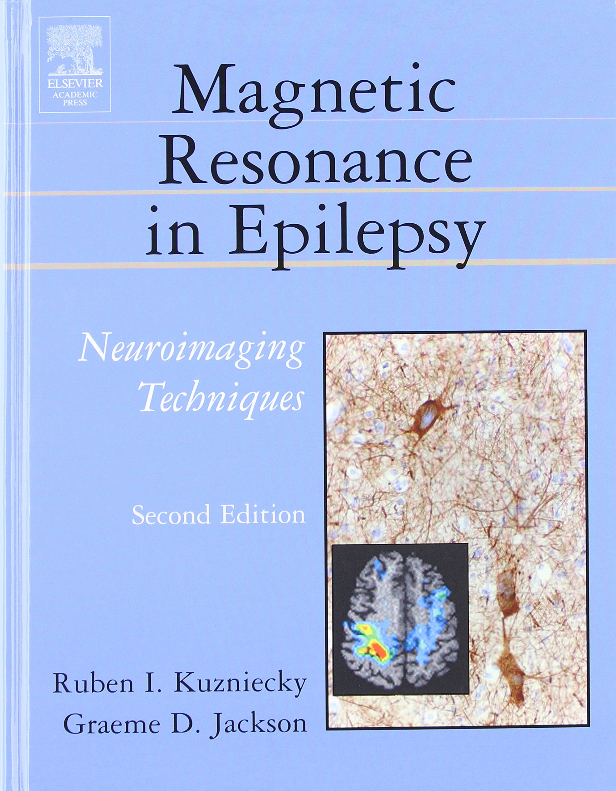 Magnetic Resonance in Epilepsy Medicine
