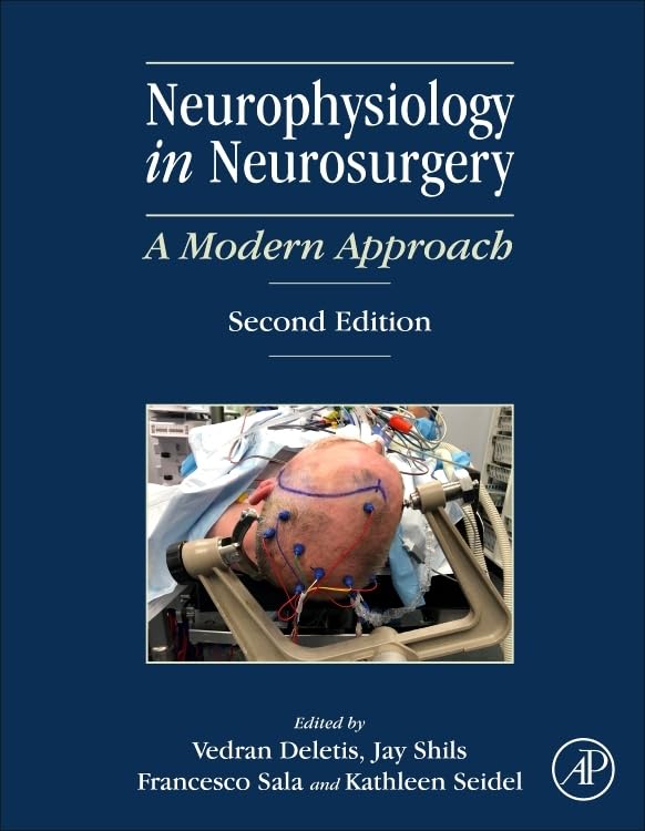 Neurophysiology in Neurosurgery: A Modern Approach Medicine