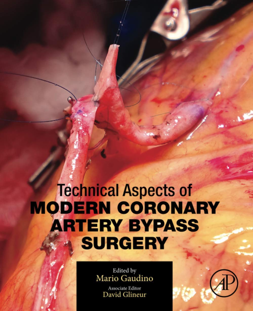 Technical Aspects of Modern Coronary Artery Bypass Surgery Medicine