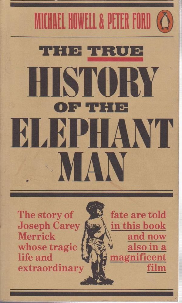 The True History of the Elephant Man Memories