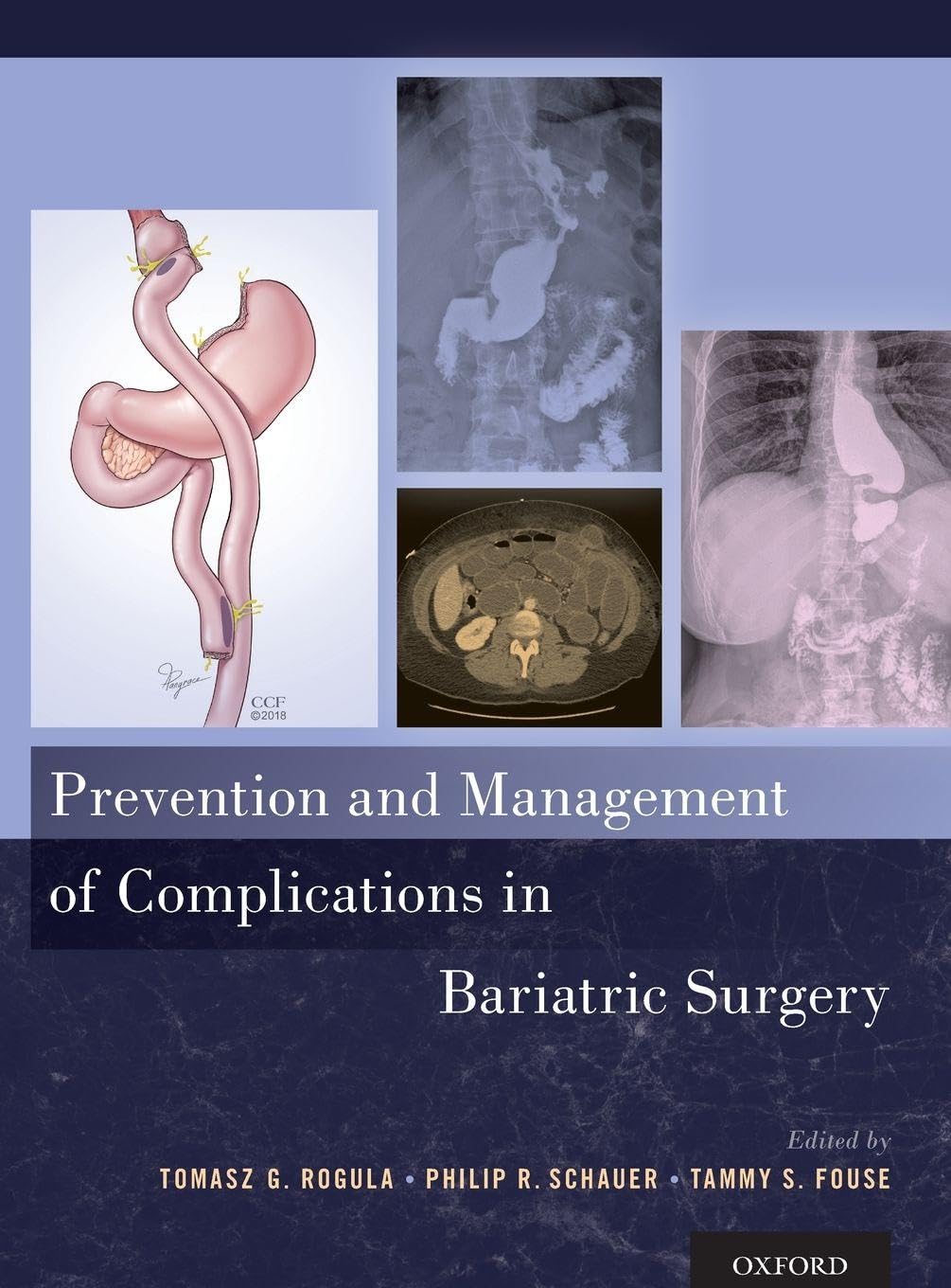 Prevention and Management of Complications in Bariatric Surgery Medicine