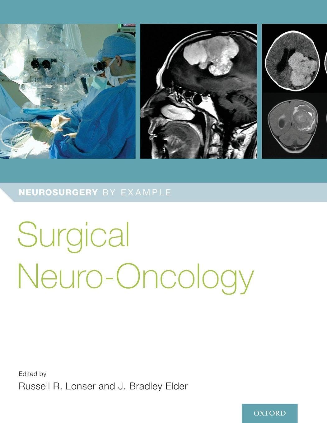 Surgical Neuro-Oncology Medicine