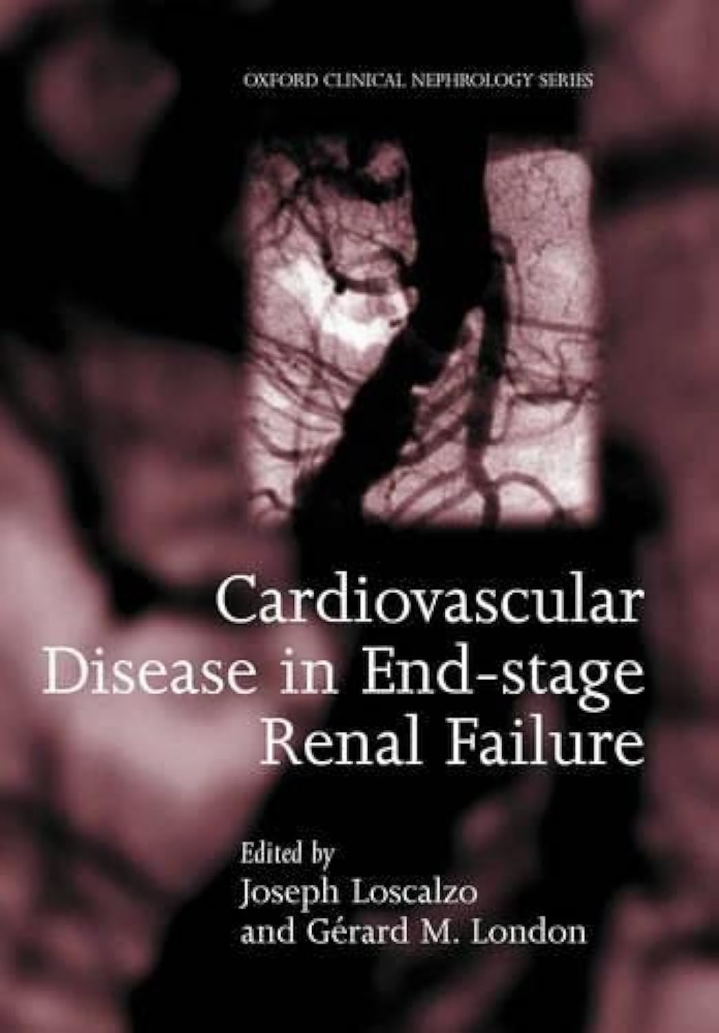 Cardiovascular Disease in End-Stage Renal Failure book
