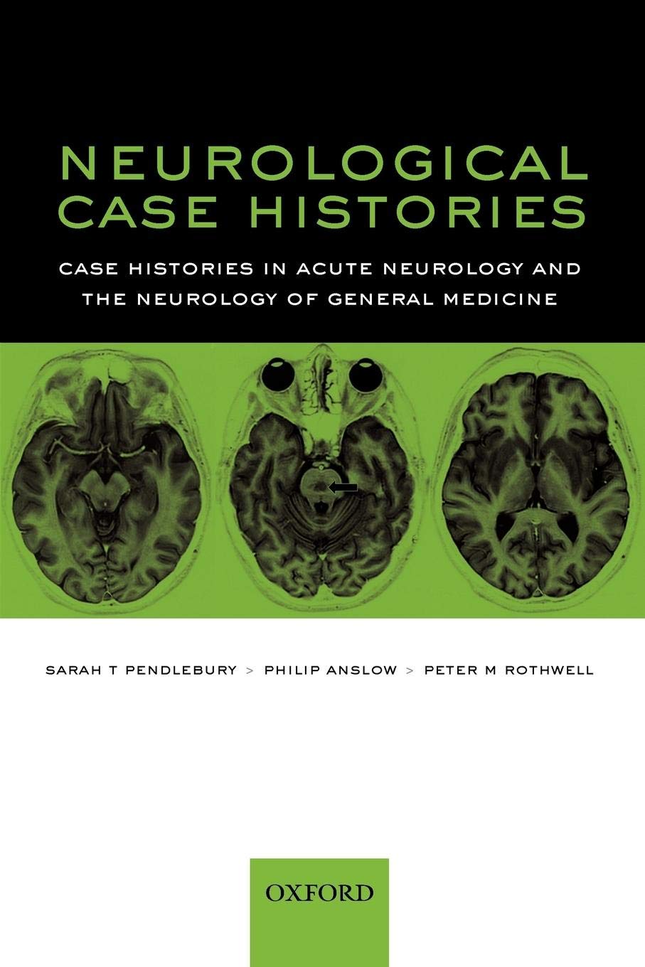Neurological Case Histories (Oxford Case Histories): Case Histories in Acute Neurology and the Neurology of General Medicine Medicine