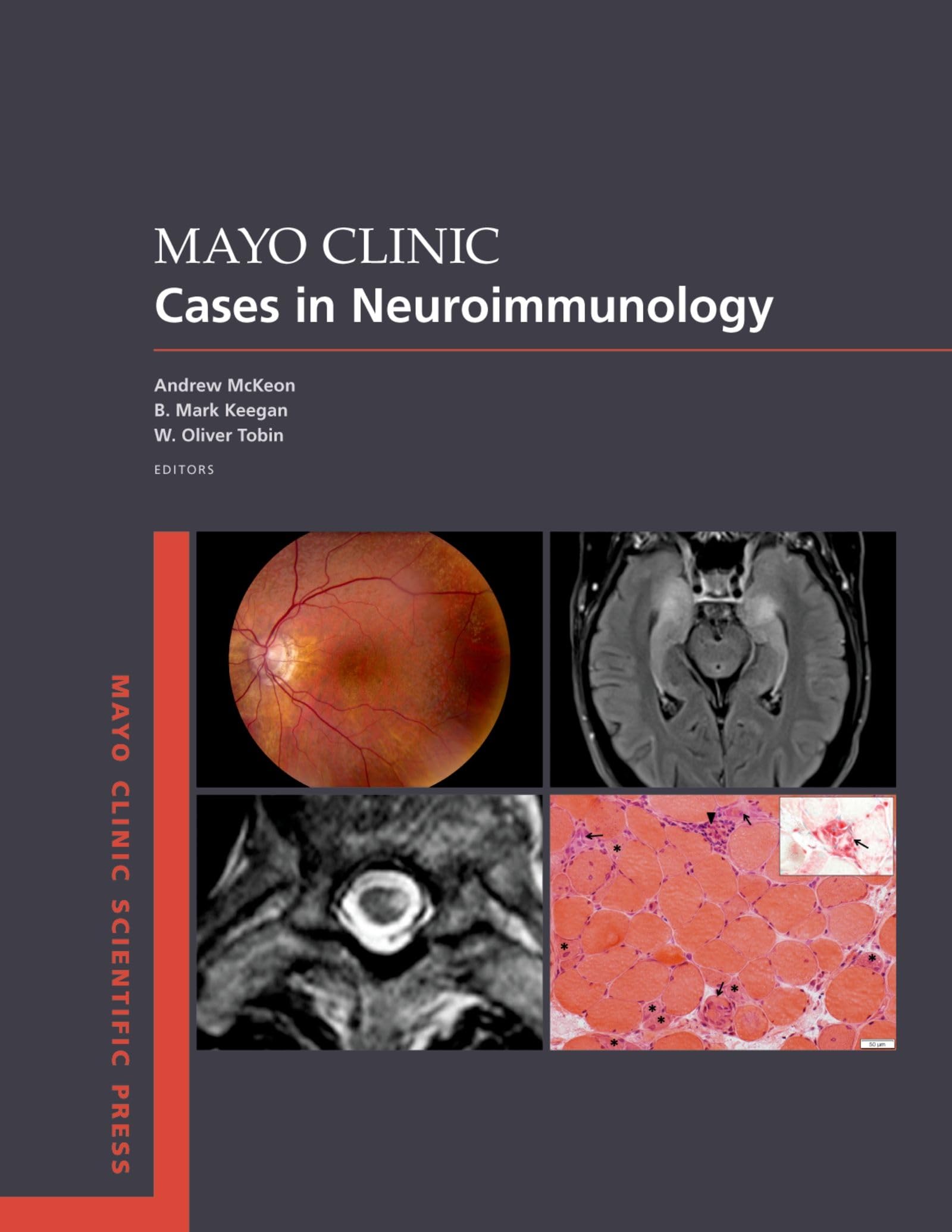 Mayo Clinic Cases in Neuroimmunology Medicine