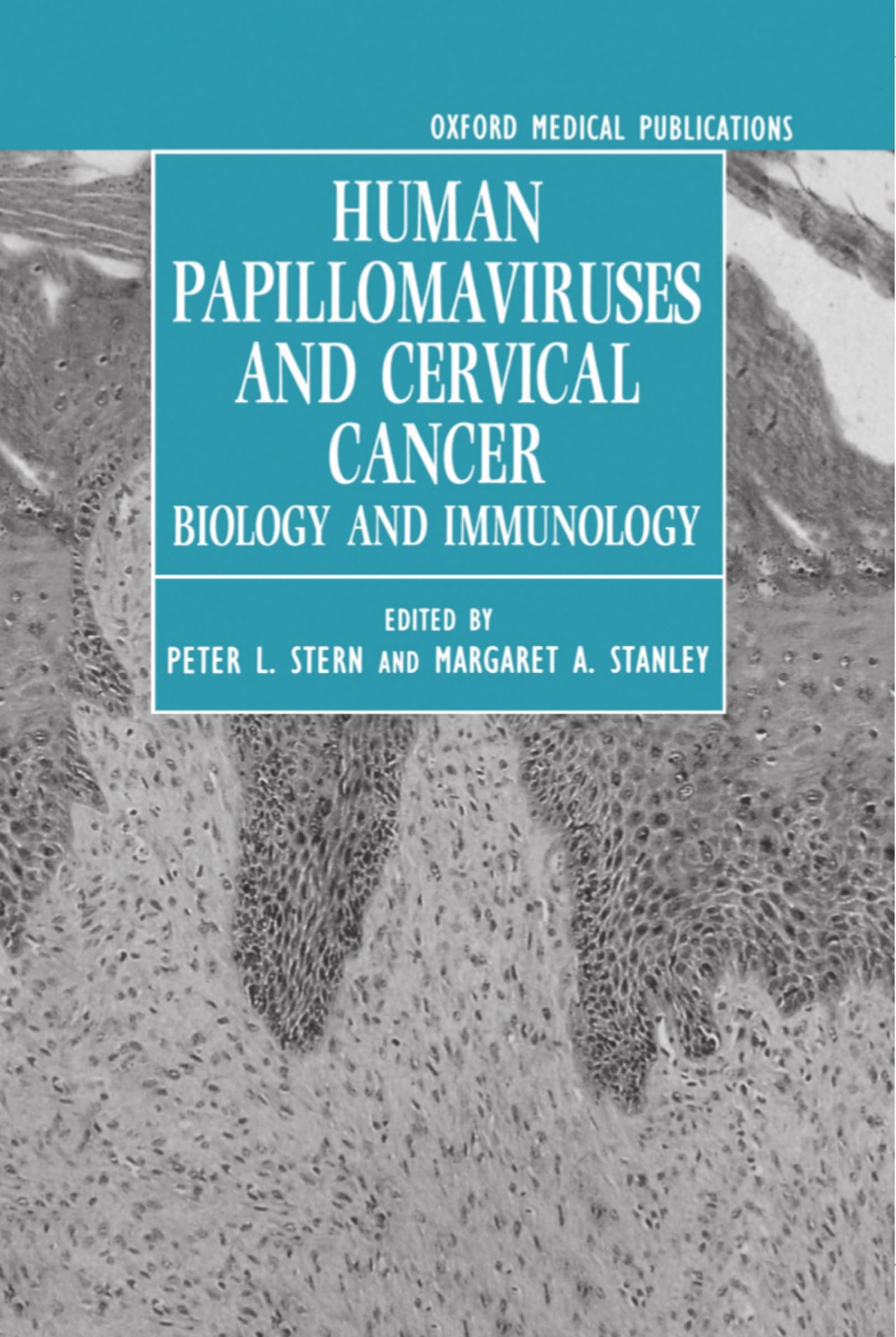 Human Papillomaviruses and Cervical Cancer Medicine