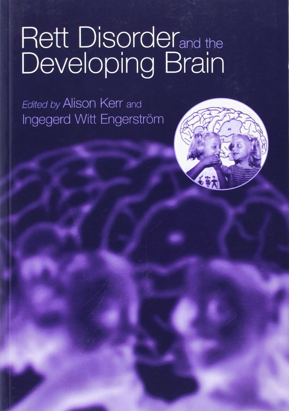 Rett Disorder and the Developing Brain Medicine