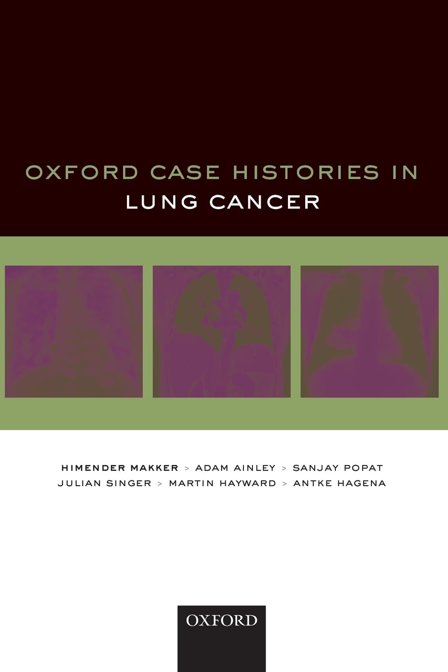 Oxford Case Histories in Lung Cancer Medicine