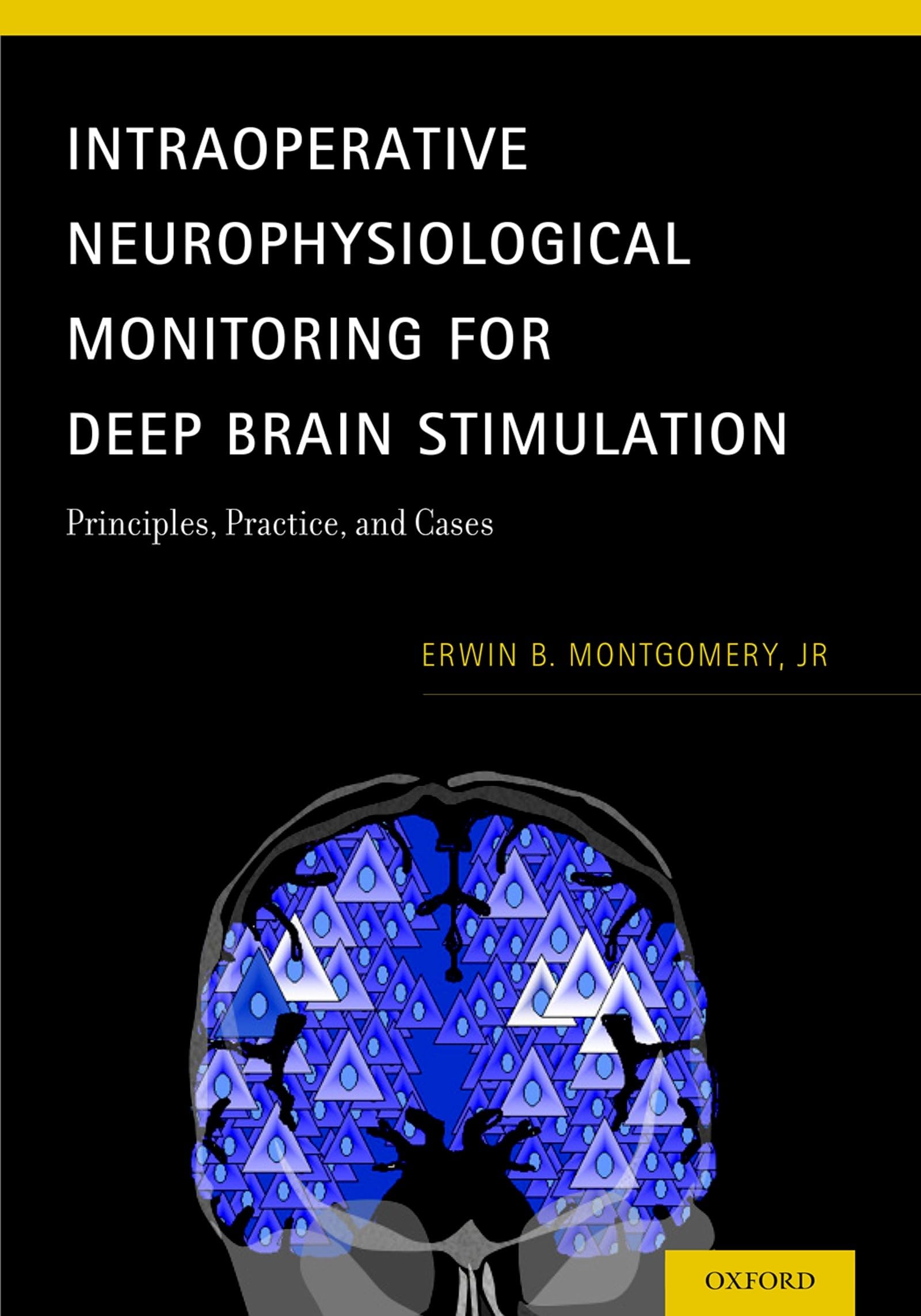 Intraoperative Neurophysiological Monitoring for Deep Brain Stimulation Medicine