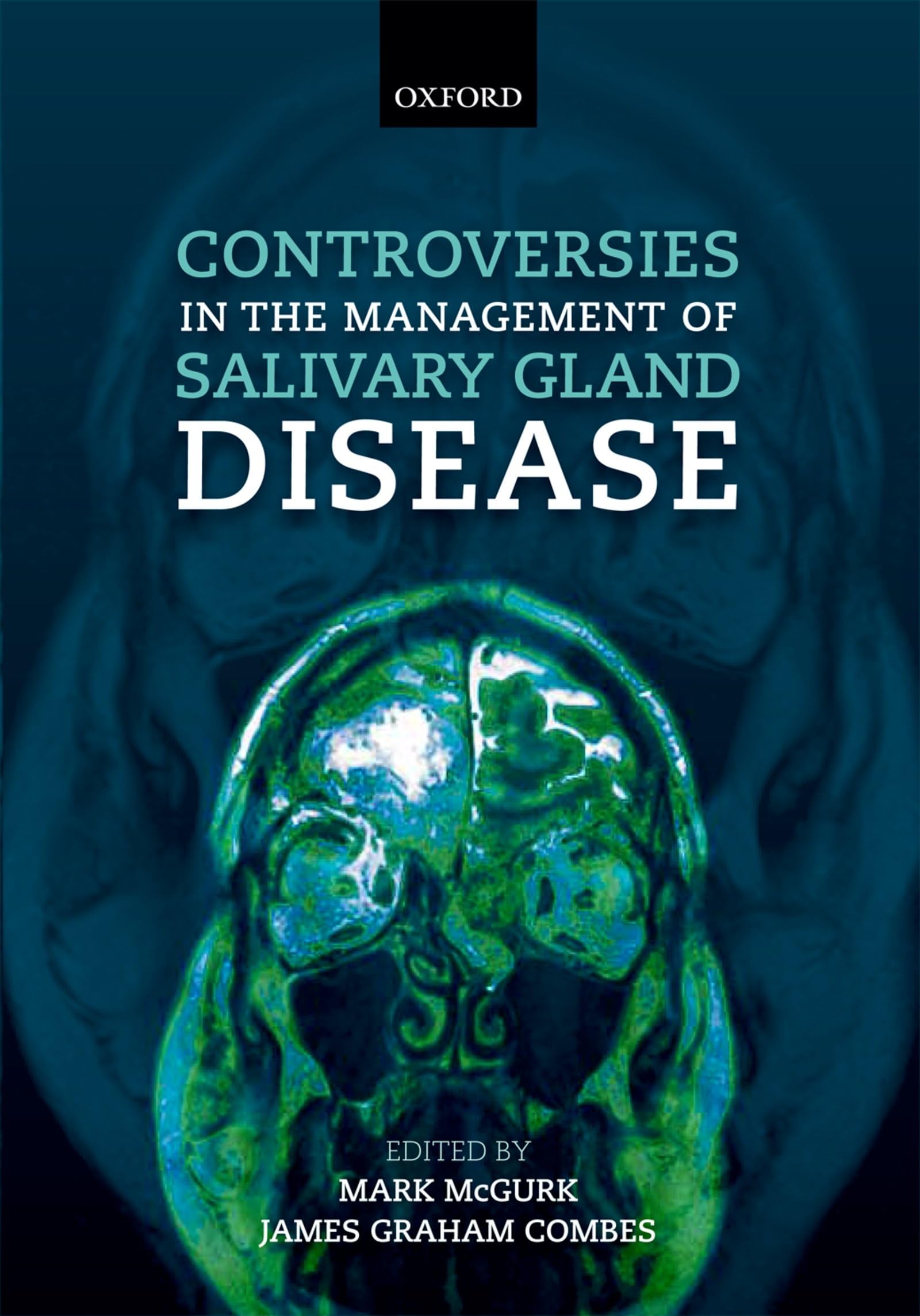 Controversies in the Management of Salivary Gland Disease Medicine