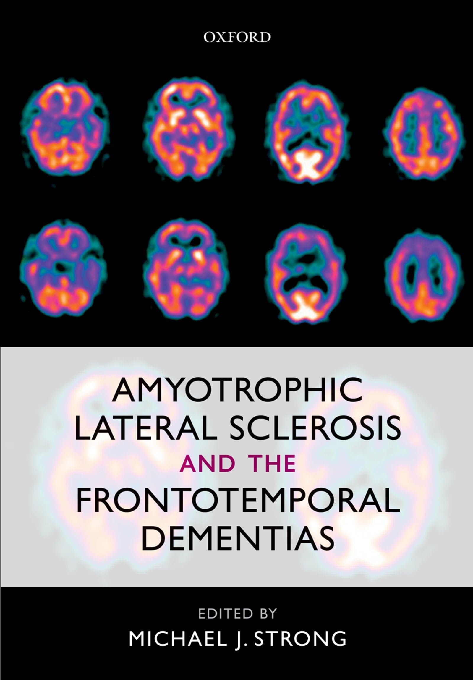 Amyotrophic Lateral Sclerosis and the Frontotemporal Dementias Medicine