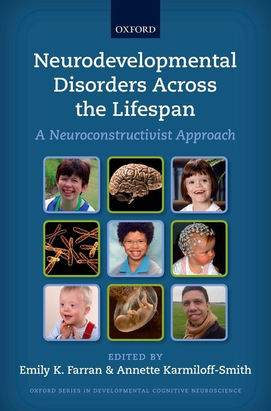 NEURODE DISORD ACROSS LIFESPAN DCN Medicine