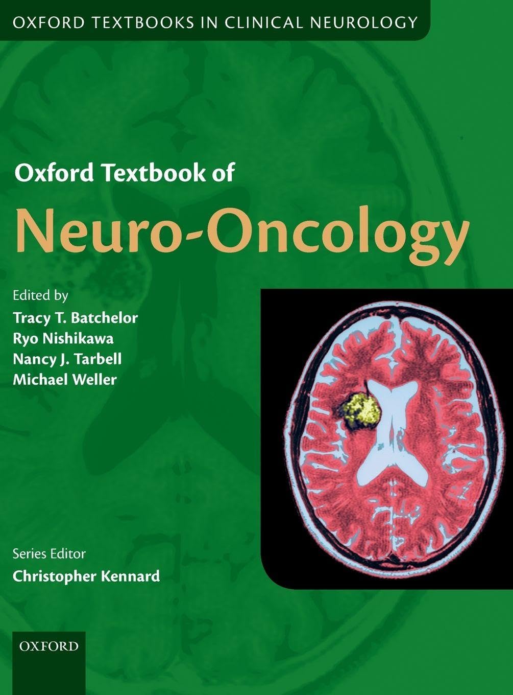 Oxford Textbook of Neuro-Oncology Medicine