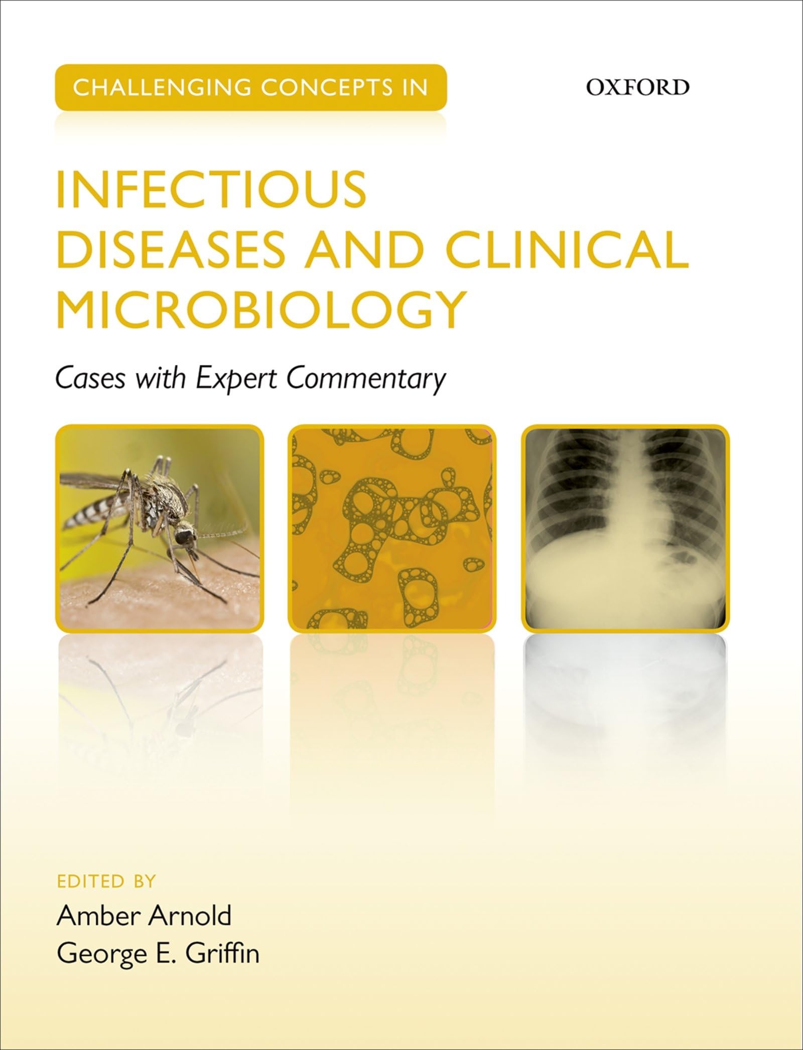 Challenging Concepts in Infectious Diseases and Clinical Microbiology: Expert Commentary Medicine