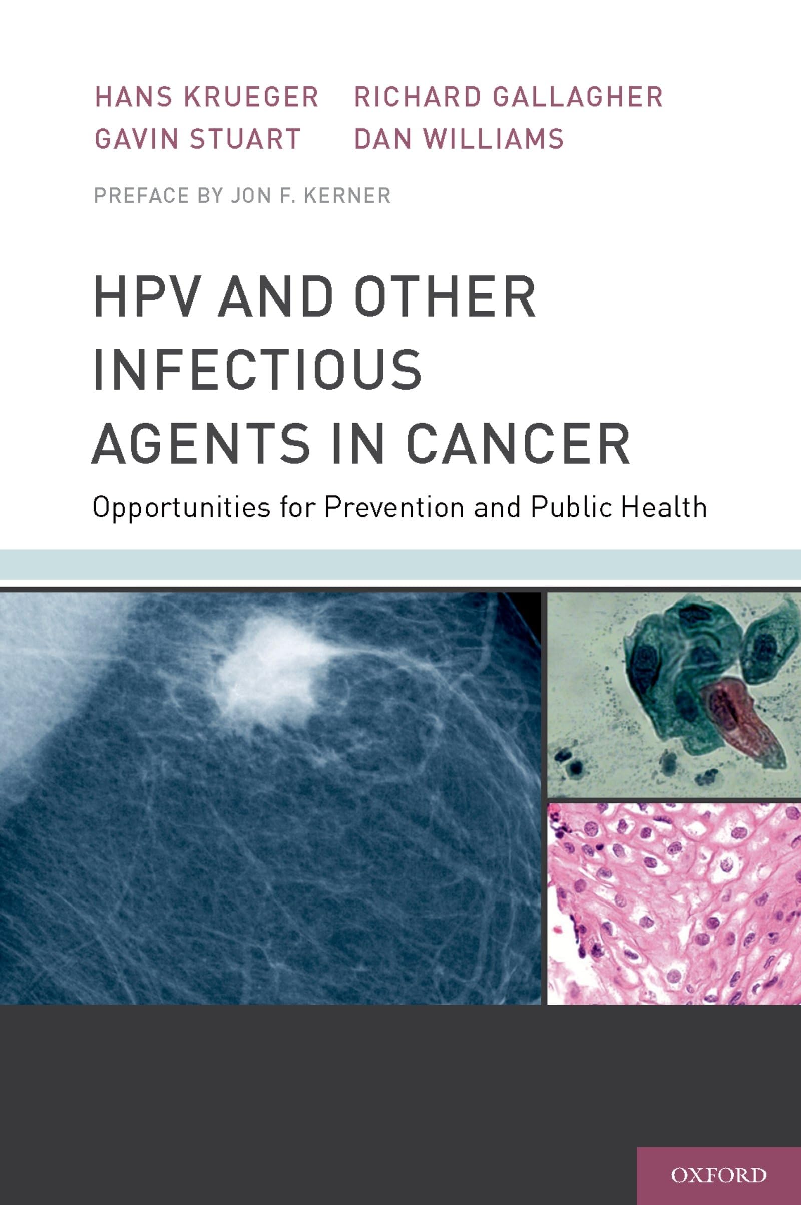 Hpv and Other Infectious Agents in Cancer Medicine