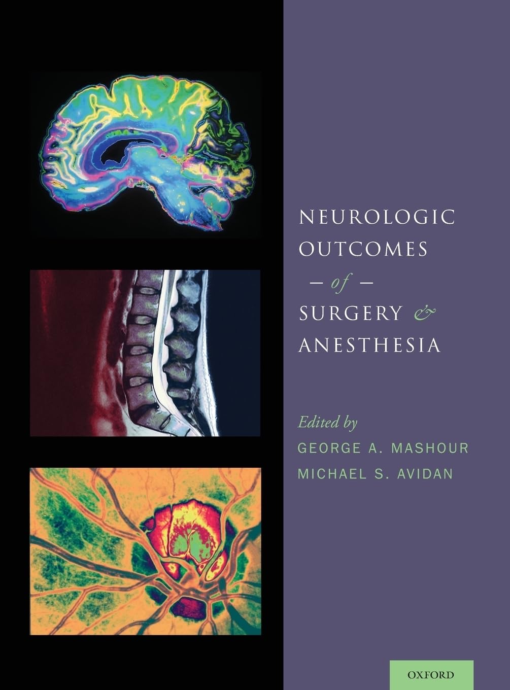 Neurologic Outcomes of Surgery and Anesthesia Medicine