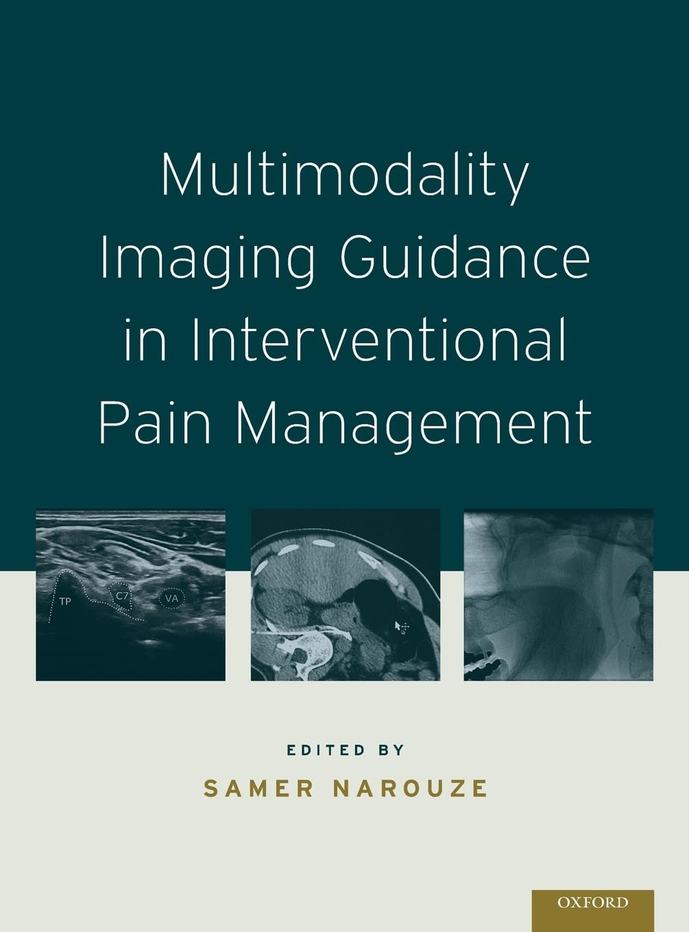 Multimodality Imaging Guidance in Interventional Pain Management Medicine