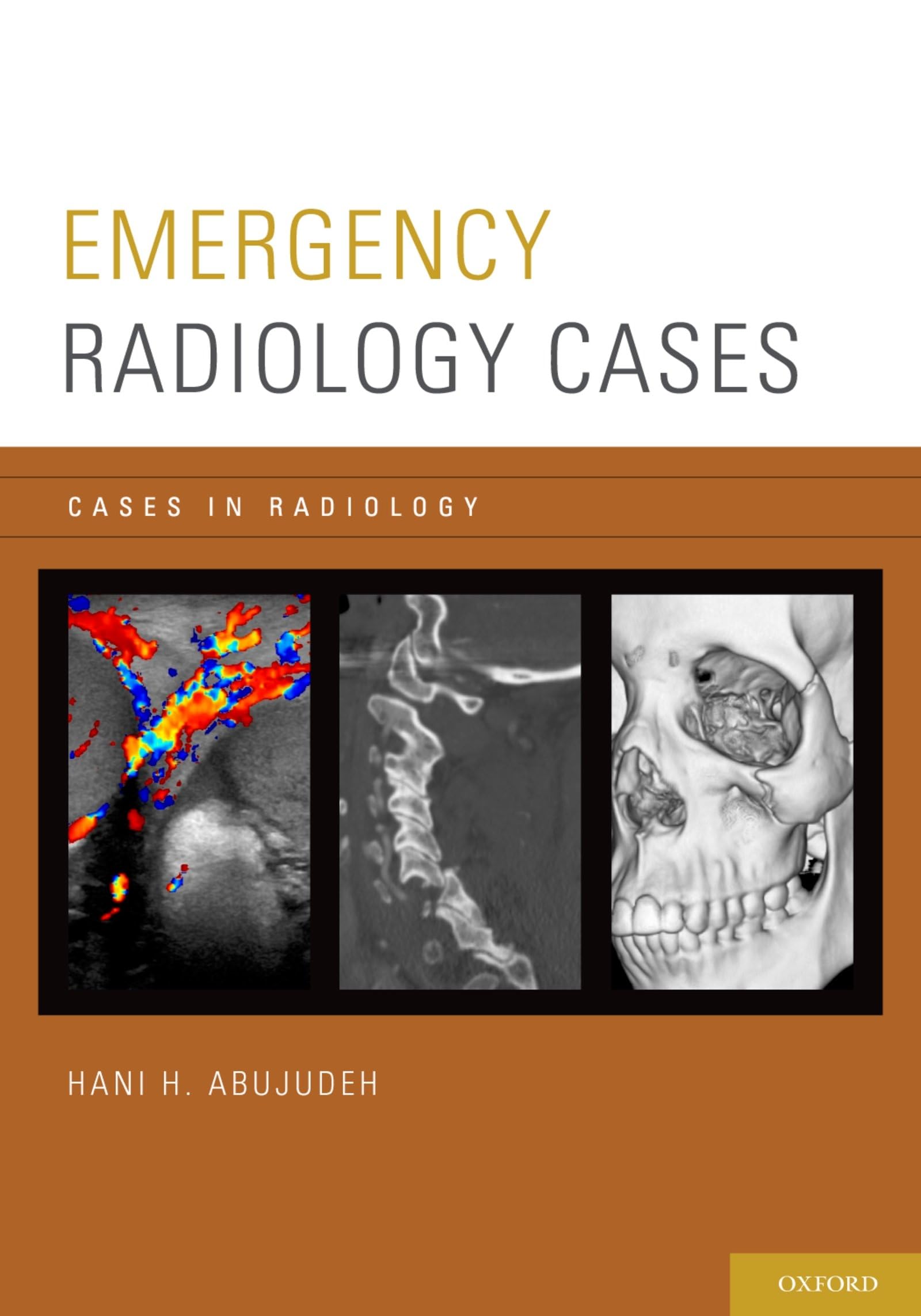 Emergency Radiology Cases (Cases in Radiology) book