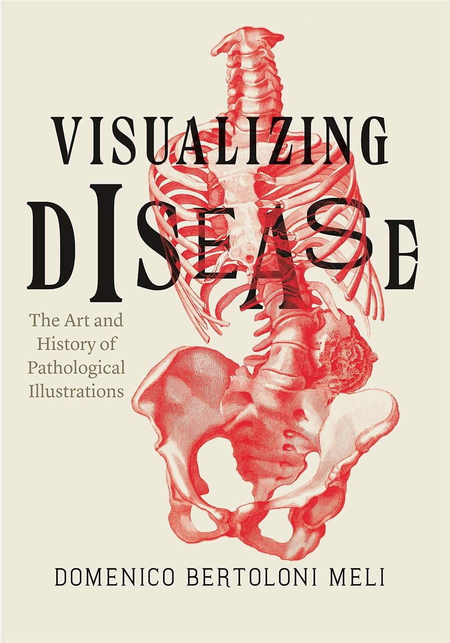 Visualizing Disease Medicine