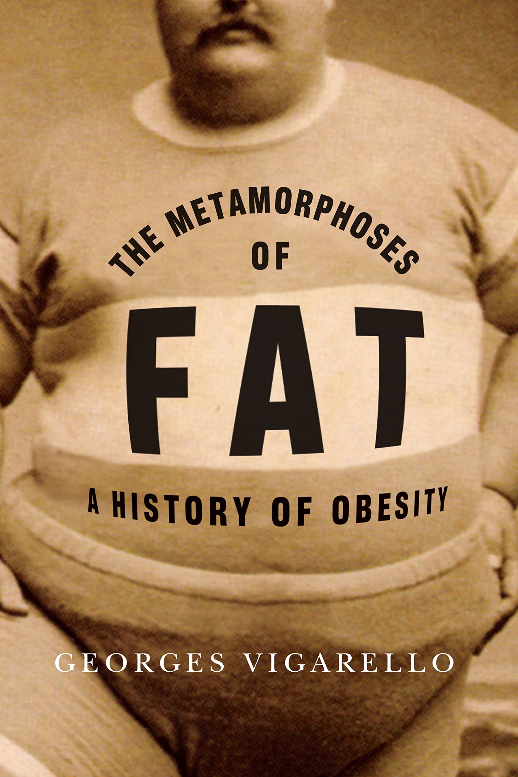 The Metamorphoses of Fat: A History of Obesity (European Perspectives: A Series in Social Thought and Cultural Criticism) Medicine