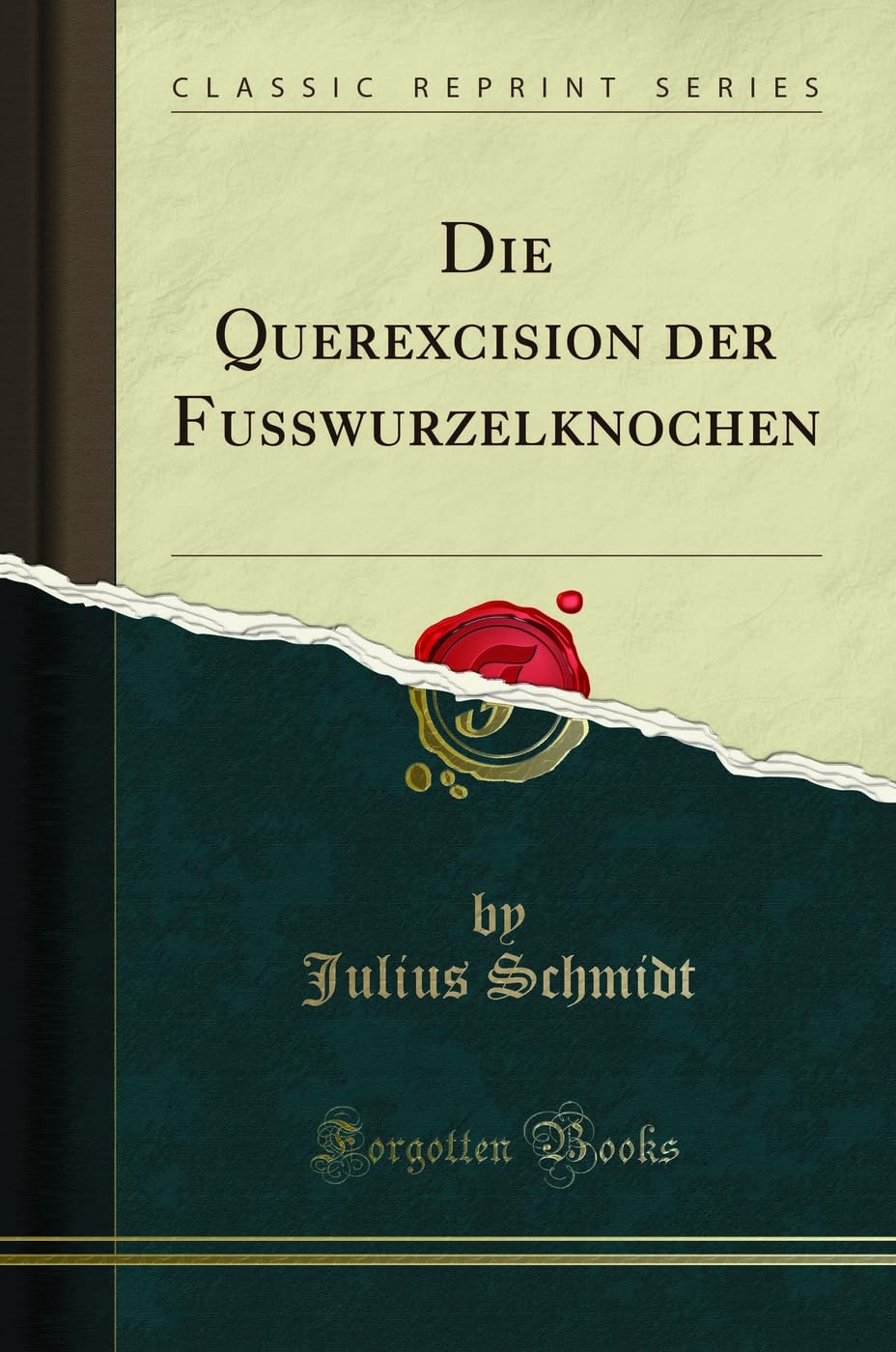 Die Querexcision der Fusswurzelknochen (Classic Reprint) Medicine