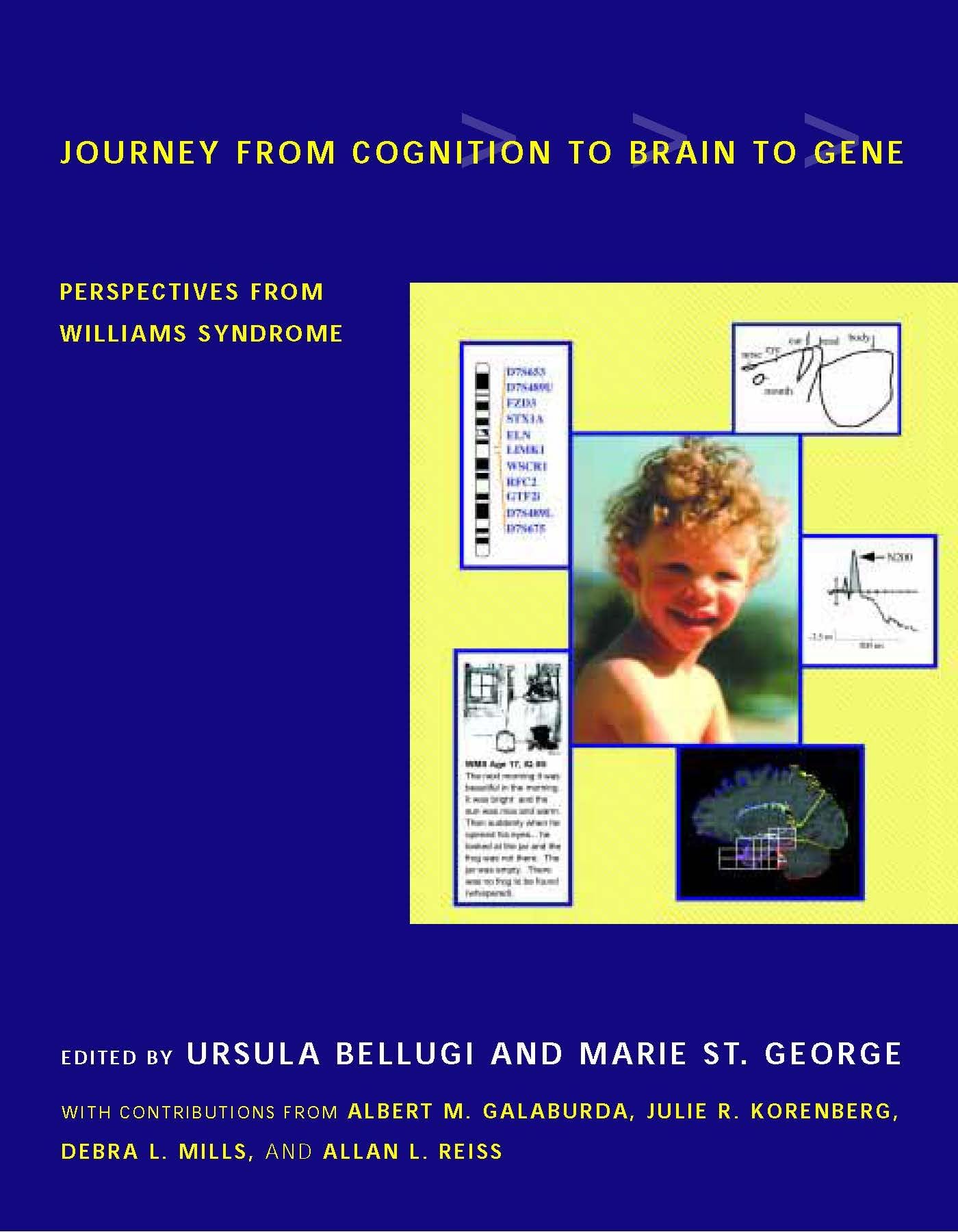 Journey from Cognition to Brain to Gene: Perspectives from Williams Syndrome book