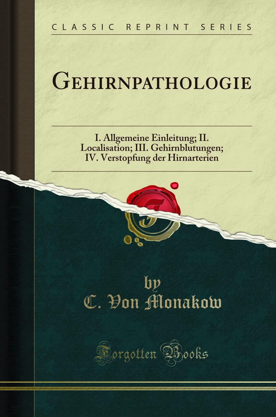 Gehirnpathologie: I. Allgemeine Einleitung; II. Localisation; III. Gehirnblutungen; IV. Verstopfung der Hirnarterien (Classic Reprint) Medicine