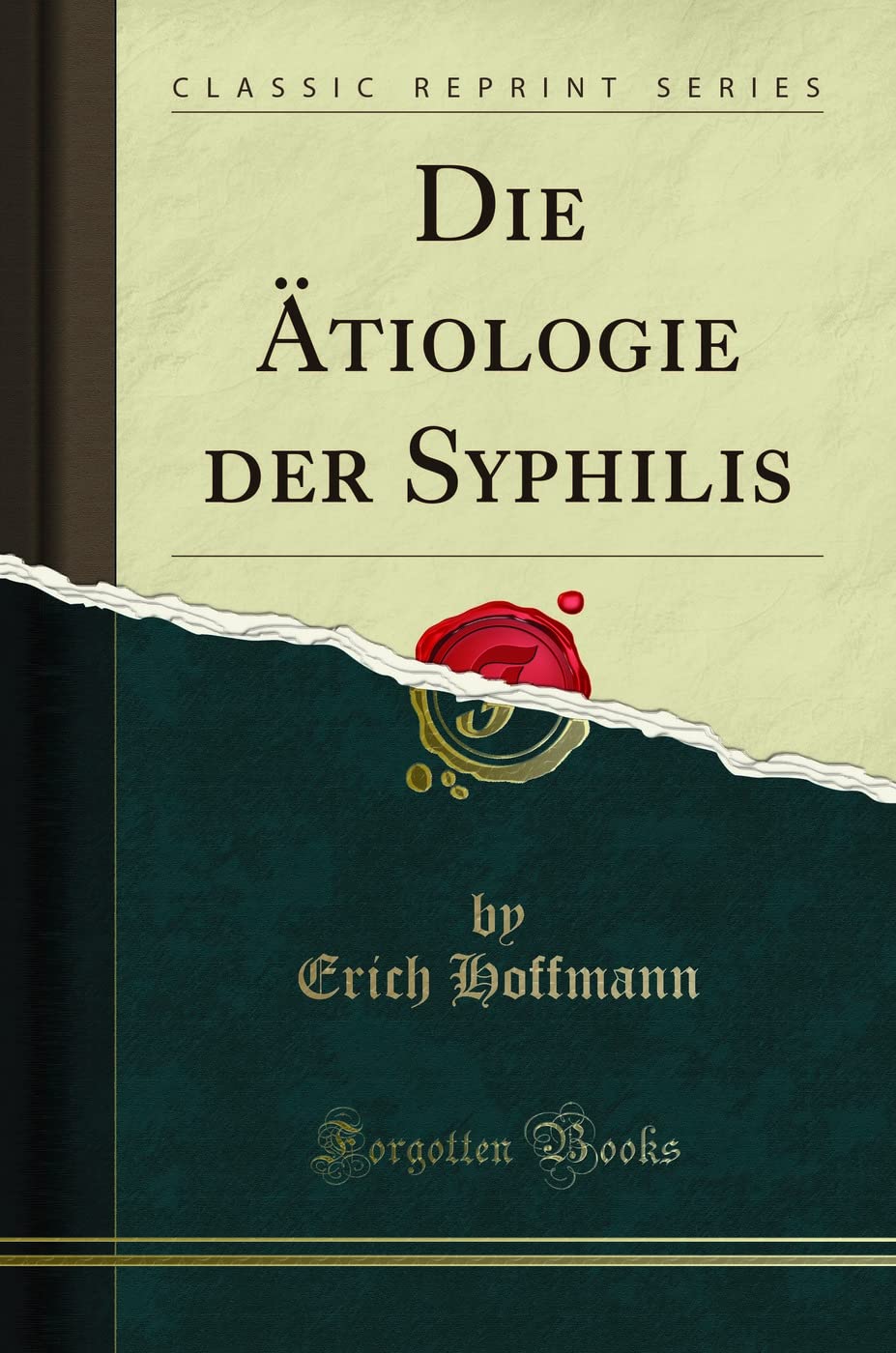 Die Ätiologie der Syphilis (Classic Reprint) Medicine