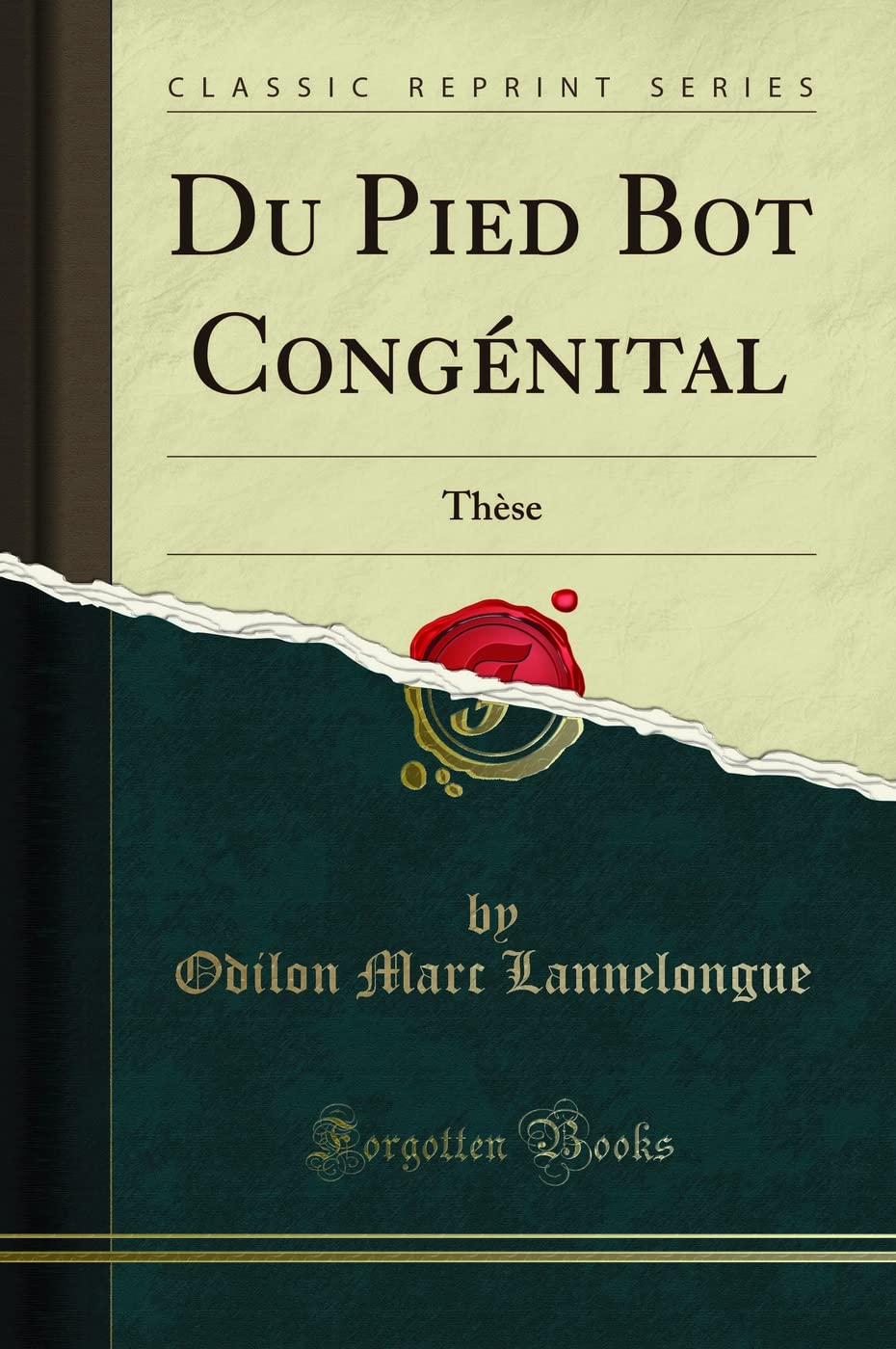 Du Pied Bot Congénital: Thèse (Classic Reprint) book
