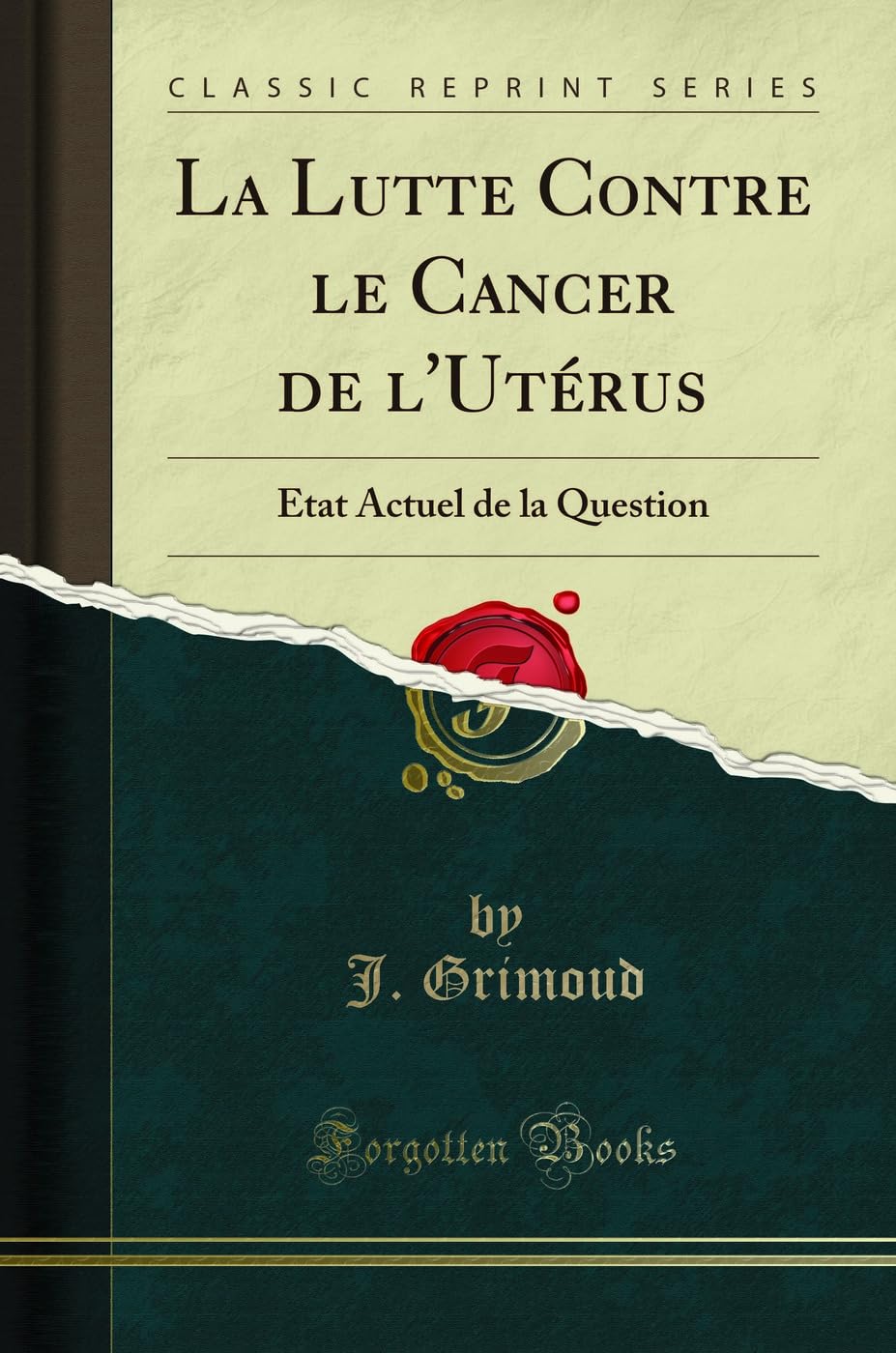 La Lutte Contre Le Cancer de l'Utérus: Etat Actuel de la Question (Classic Reprint) book