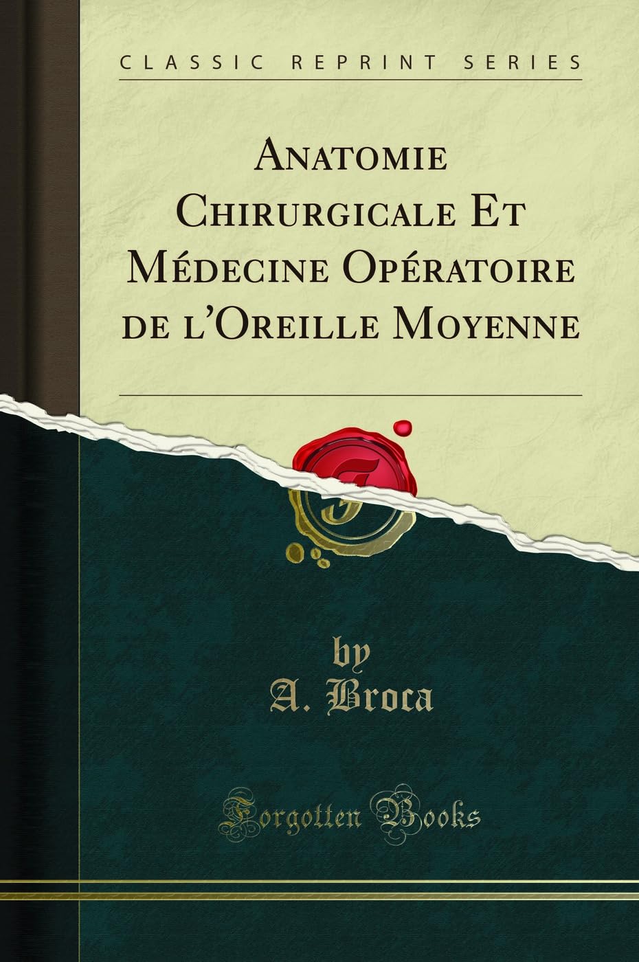 Anatomie Chirurgicale Et Médecine Opératoire de l'Oreille Moyenne (Classic Reprint) book