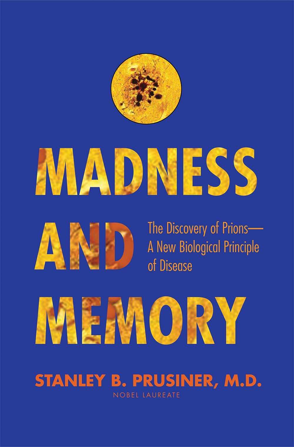 Madness and Memory: The Discovery of Prions: A New Biological Principle of Disease book