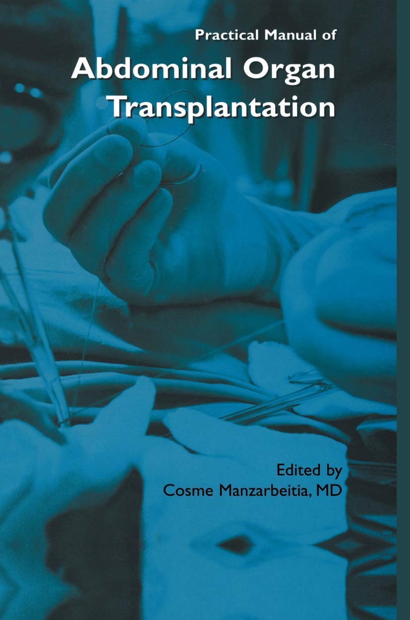 Practical Manual of Abdominal Organ Transplantation Medicine