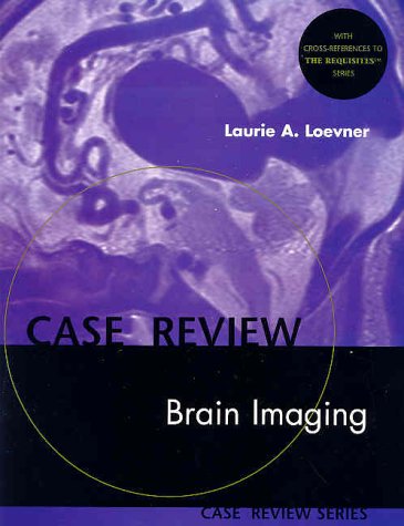 Brain Imaging: Case Review (Case Review Series) Medicine