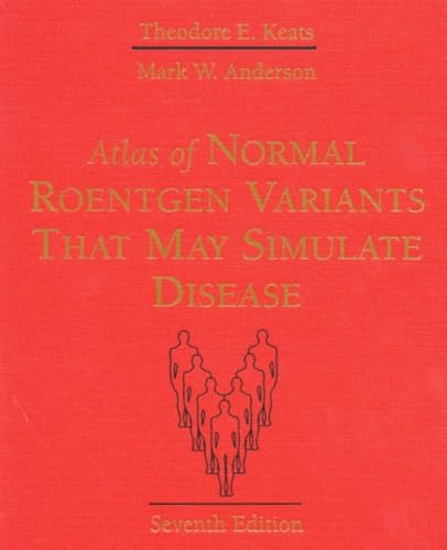 Atlas of Normal Roentgen Variants That May Simulate Disease Medicine