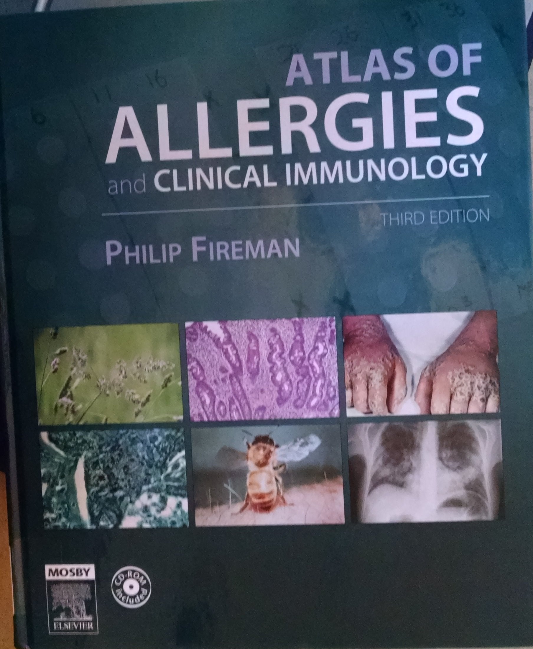 Atlas of Allergies And Clinical Immunology Medicine