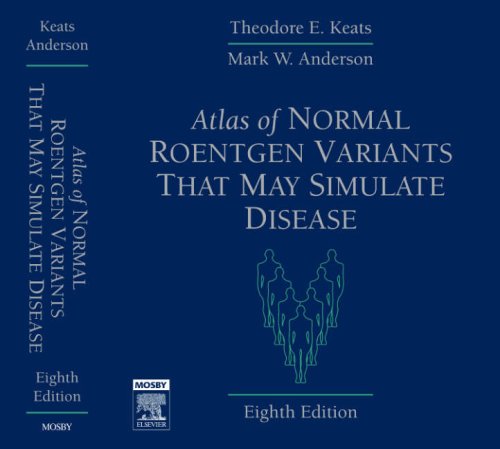 Atlas of Normal Roentgen Variants That May Simulate Disease Medicine